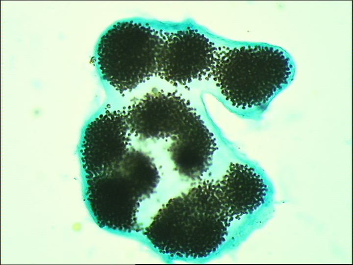 Microcystis, une cyanobactérie toxique qui prend une coloration bleue